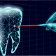 دندانپزشکی لیزری: کاربردها، مزایا و معایب