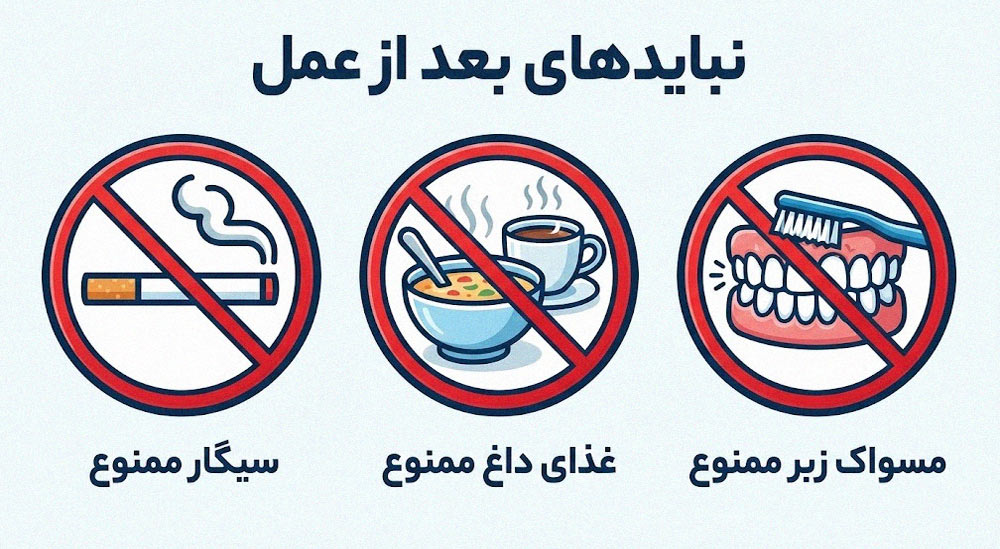 آیکون‌های گرافیکی سیگار ممنوع، غذای داغ ممنوع و مسواک زبر ممنوع بعد از درمان تحلیل لثه با لیزر