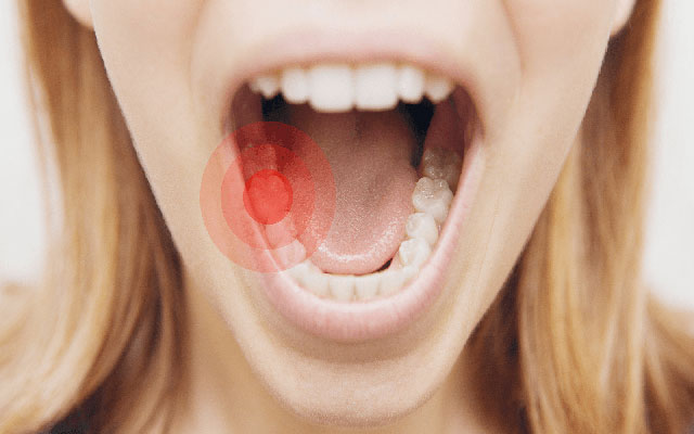 چگونه دندان درد را تسکین دهیم؟
