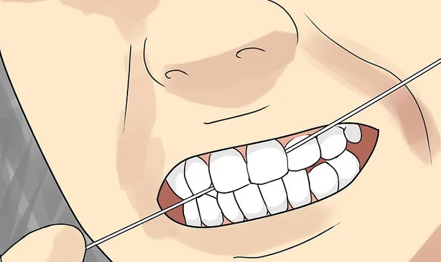 کشیدن نخ دندان