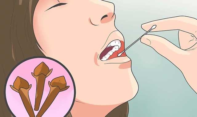 قرار دادن روغن میخک روی دندان عفونتی