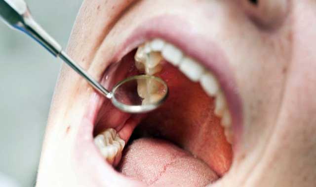 دیگر علائم تشخیص عفونت دندان