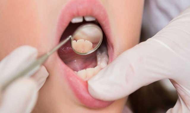 چگونگی تشخیص عفونت دندان