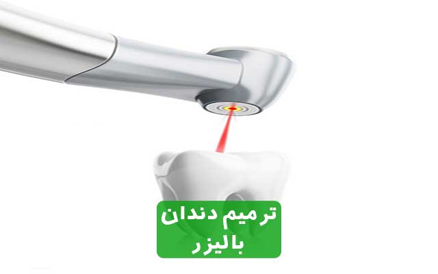 ترمیم دندان با لیزر بهترین روش رفع پوسیدگی دندان