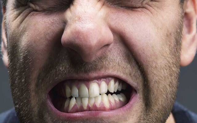 دندان قروچه یا بروکسیسم