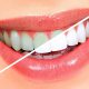 سفید کردن دندان (بلیچینگ)