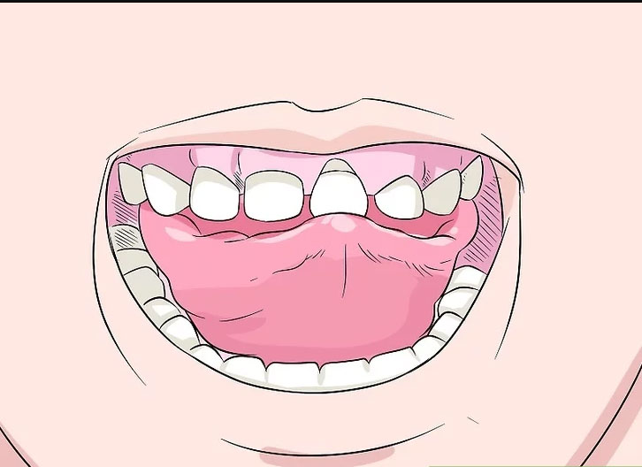 تکان دادن دندان لق
