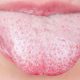 علت سفیدی زبان و بوی بد دهان