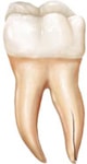 شکستگی عمودی ریشه دندان