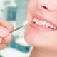 عوارض و معایب لمینت دندان