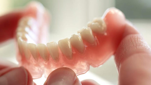 دندان مصنوعی در مقابل روکش دندان
