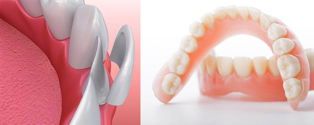دندان مصنوعی یا روکش دندان را انتخاب کنیم؟