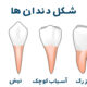 انواع شکل دندان ها