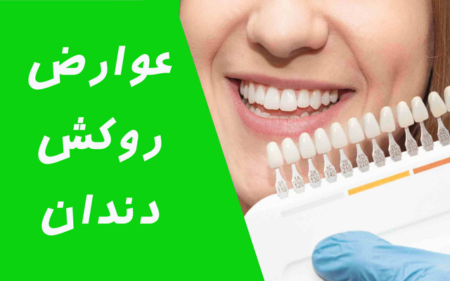 عوارض روکش دندان