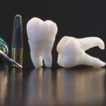 مراحل ساخت روکش دندان در لابراتور