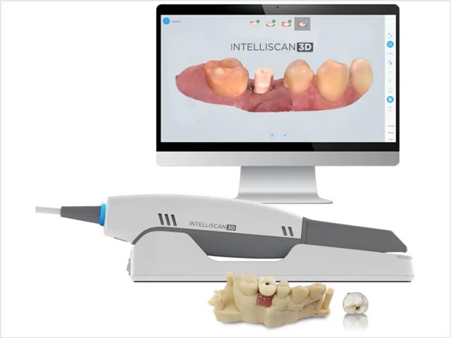 اسکن ۳ بعدی و طراحی دیجیتال روکش دندان