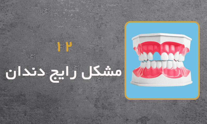 12 مشکل رایج دندان