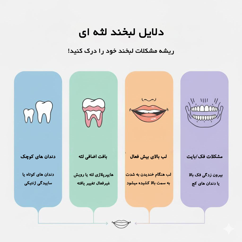 دلایل لبخند لثه ای