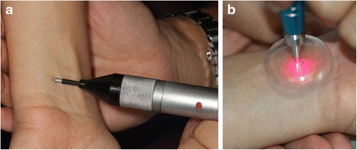 لیزر درمانی رفلکس گگ 
(حالت تهوع) در دندانپرشکی