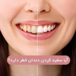 آیا سفید کردن دندان(بلیچینگ) به دندان ها آسیب میزند؟