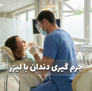 جرم گیری دندان با لیزر