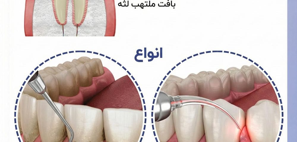 درمان های تحلیل لثه بدون جراحی