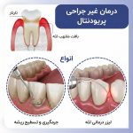 درمان های تحلیل لثه بدون جراحی