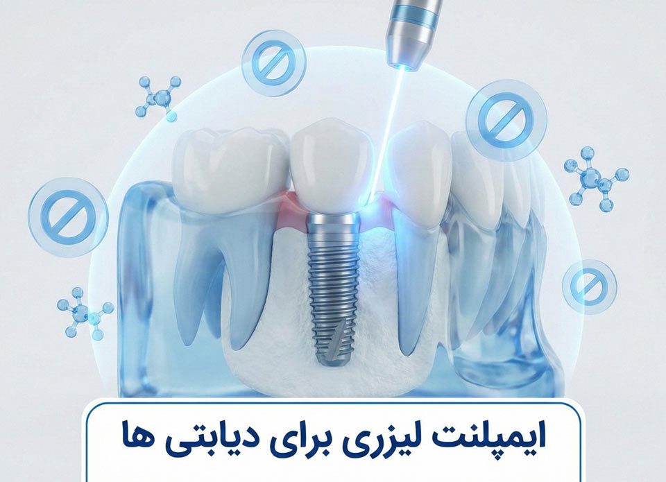 کاشت ایمپلنت دندان برای افراد دیابتی با لیزر