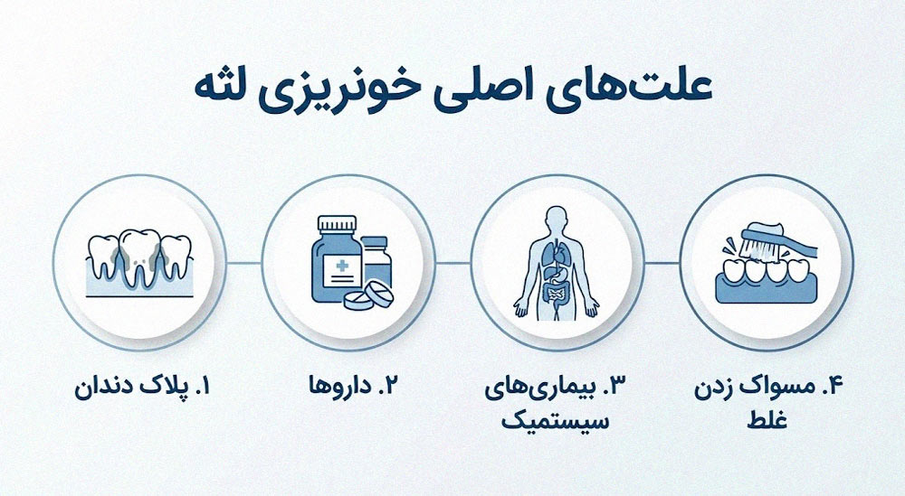اینفوگرافیک علت‌های اصلی خونریزی لثه شامل پلاک دندان و بیماری‌های سیستمیک
