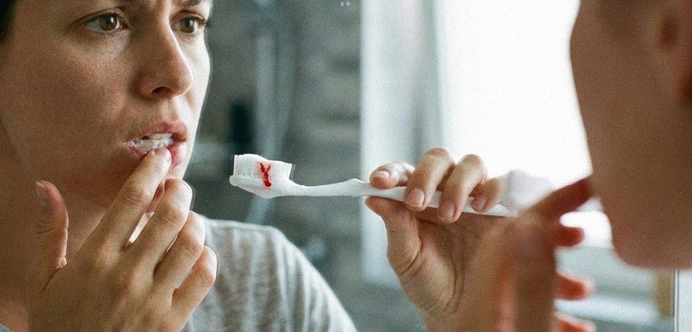 خونریزی لثه