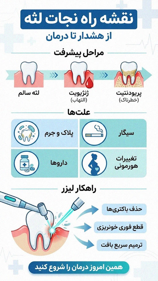 اینفوگرافی نقشه راه نجات لثه؛ نمایش مراحل پیشرفت بیماری از ژنژیویت تا پریودنتیت، علل شایع مثل پلاک و سیگار، و سه مزیت اصلی درمان خونریزی لثه با لیزر شامل حذف باکتری و قطع خونریزی.