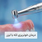 درمان خونریزی لثه با لیزر