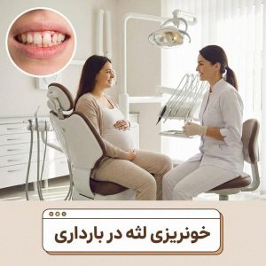 خونریزی لثه در بارداری: علل، خطرات و درمان