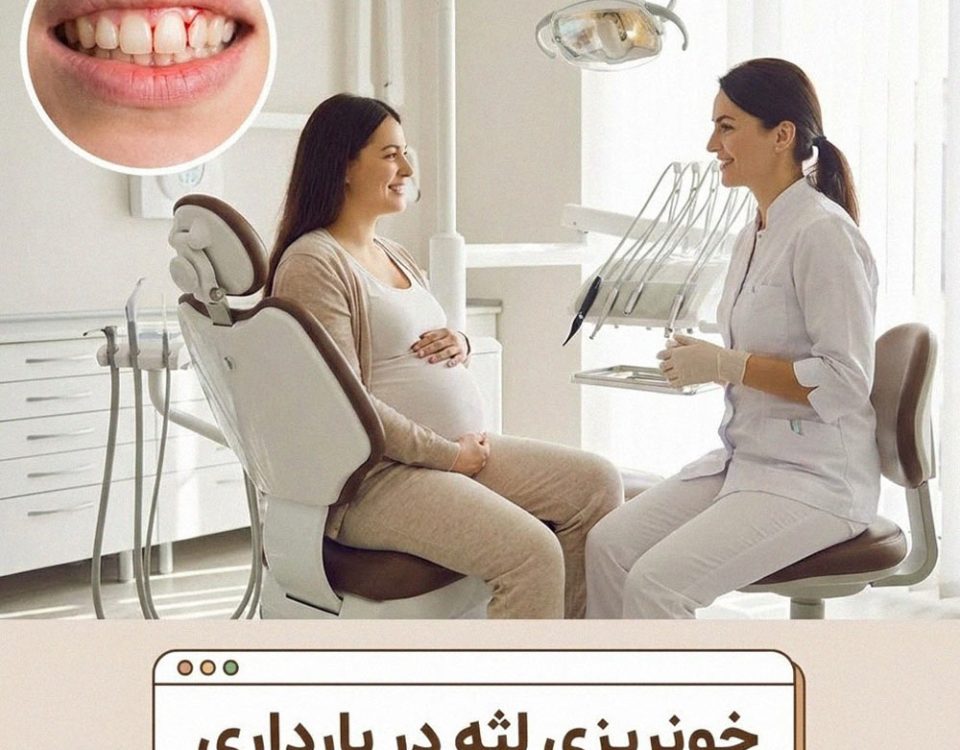 خونریزی لثه در بارداری: علل، خطرات و درمان