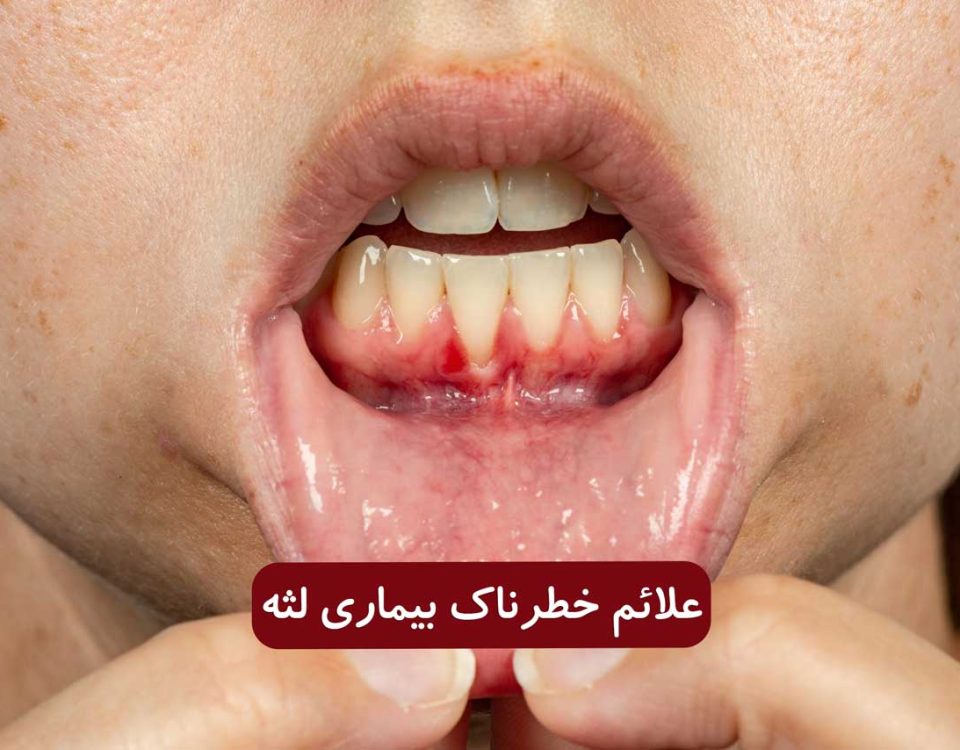 نشانه های خطرناک بیماری لثه که نباید نادیده بگیرید