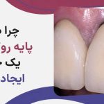 سیاه شدن لثه بعد از روکش دندان