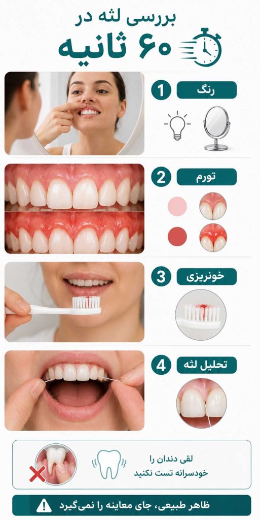 بررسی اولیه لثه توسط خود فرد
