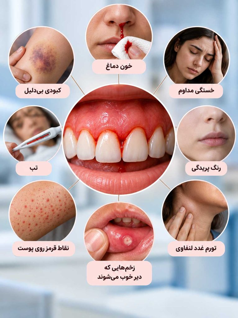 علائم همراه خونریزی لثه مانند خون دماغ، کبودی، خستگی، تب و رنگ پریدگی