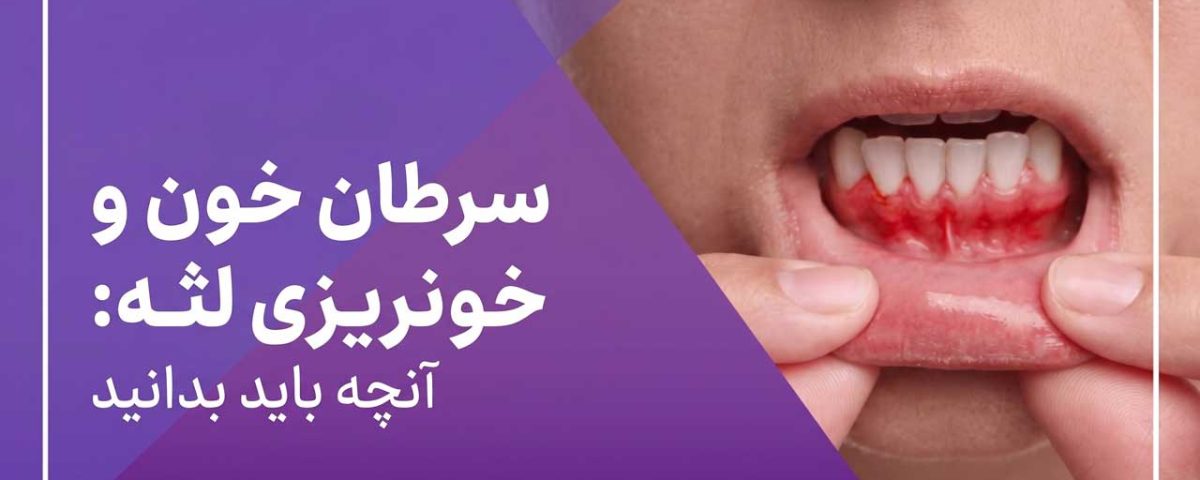 خونریزی لثه و سرطان خون