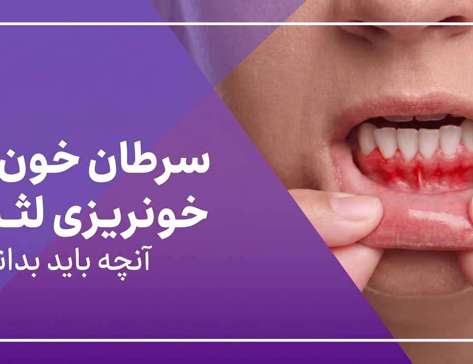 خونریزی لثه و سرطان خون