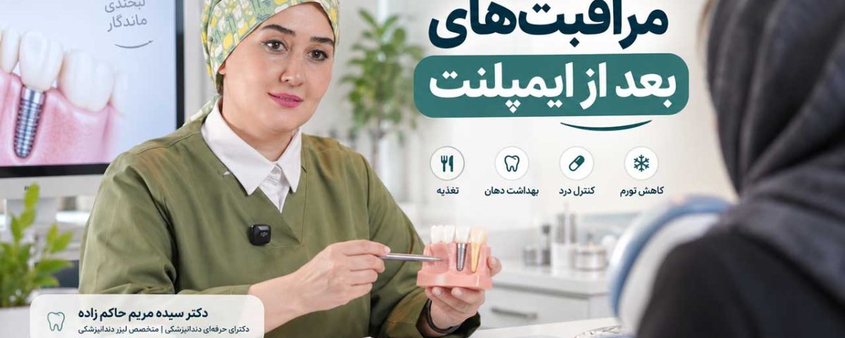 مراقبت‌های بعد از ایمپلنت دندان