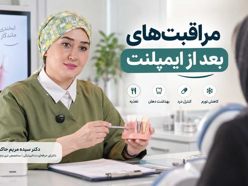 مراقبت‌های بعد از ایمپلنت دندان