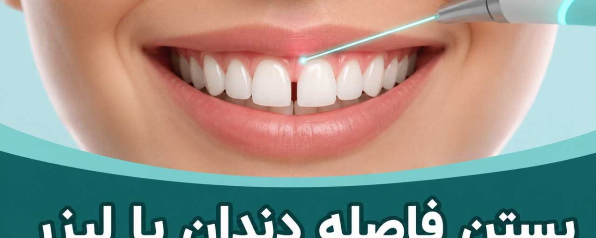 بستن فاصله دندان با لیزر