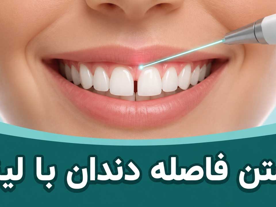 بستن فاصله دندان با لیزر