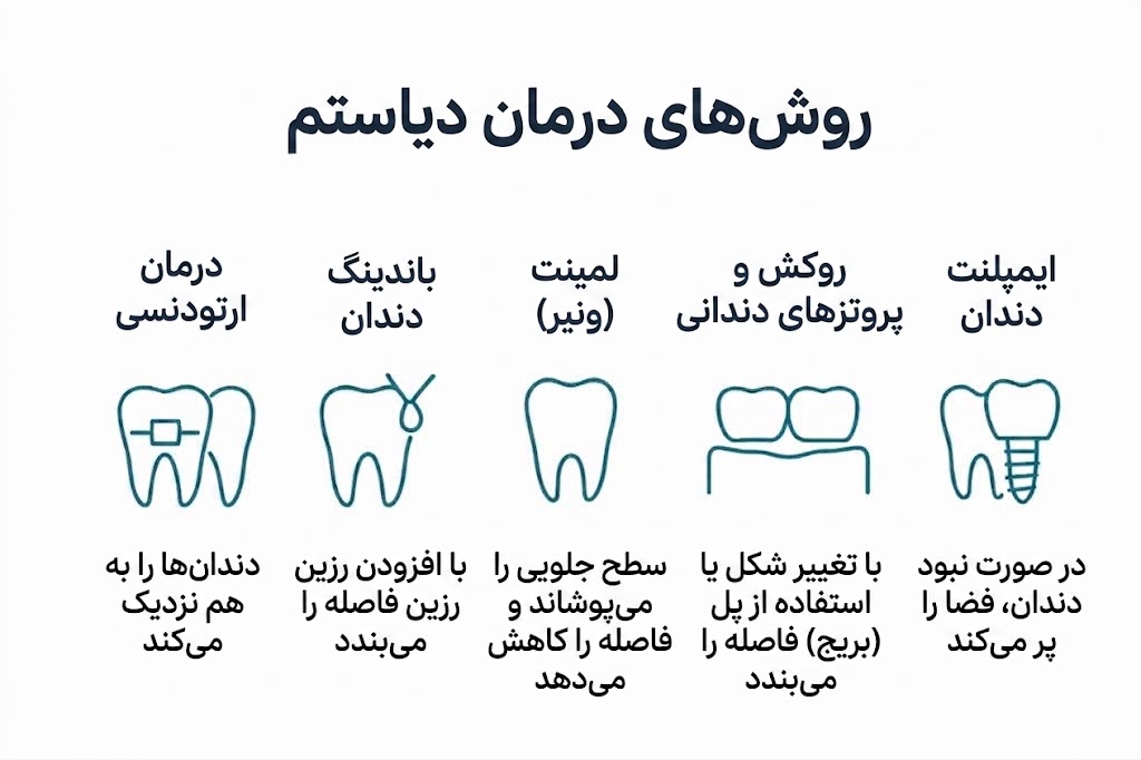  روش های بستن فاصله دندان