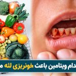 کمبود کدام ویتامین باعث خونریزی لثه میشود؟